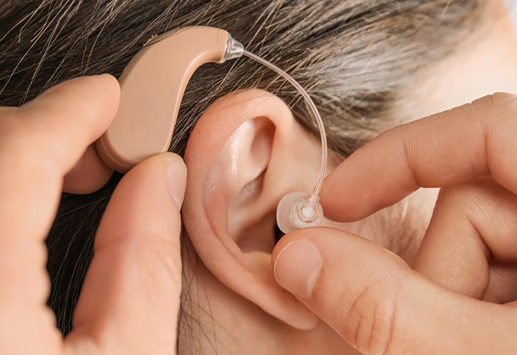 In Canal Hearing Aid